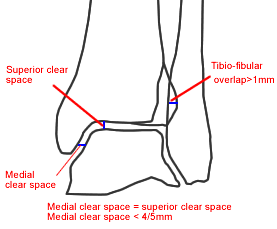 Ankle Mortise View
